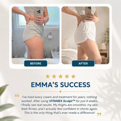 VITANEX Sculpt™ - Smart Body Shaping Massage