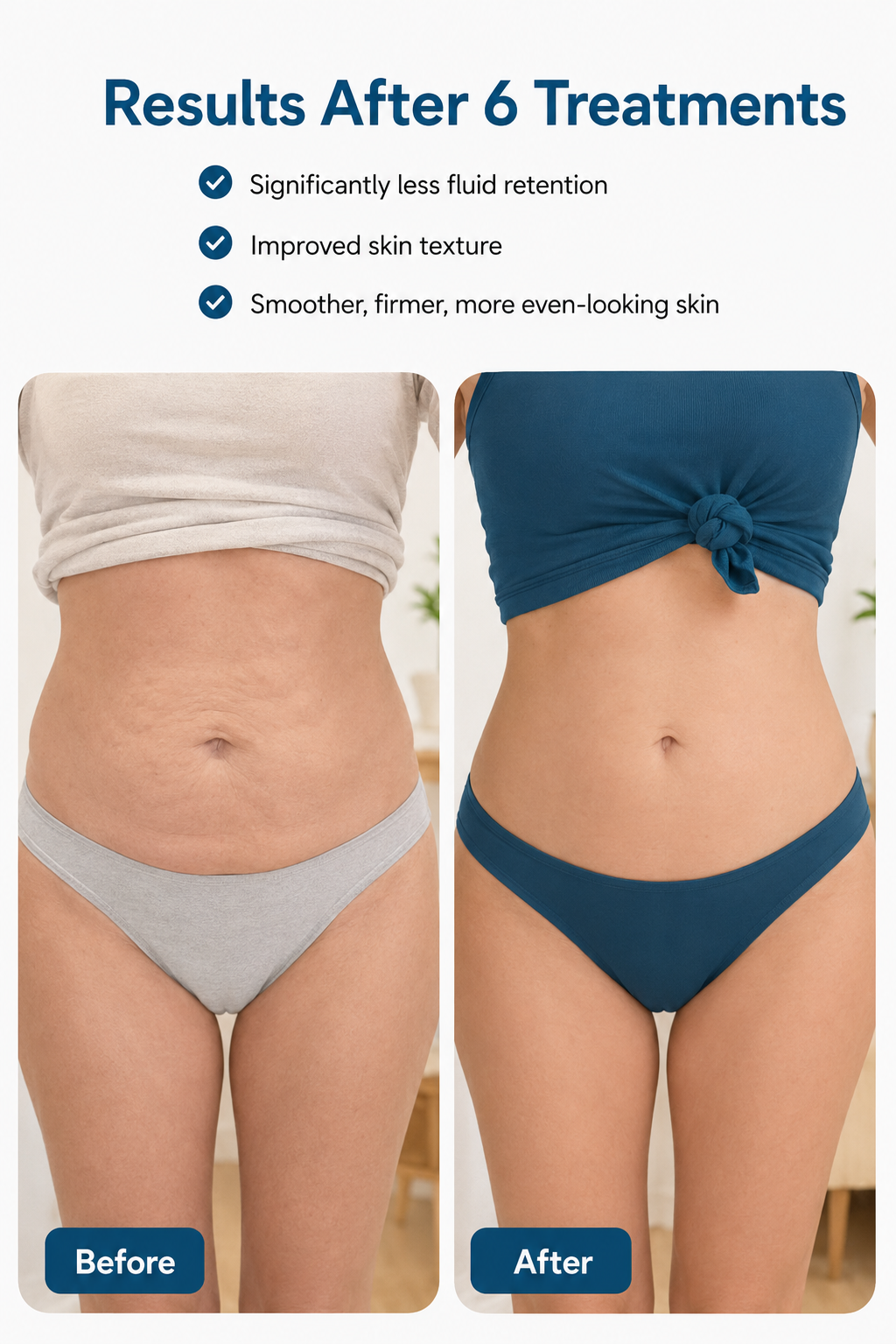 VITANEX Sculpt™ - Smart Body Shaping Massage