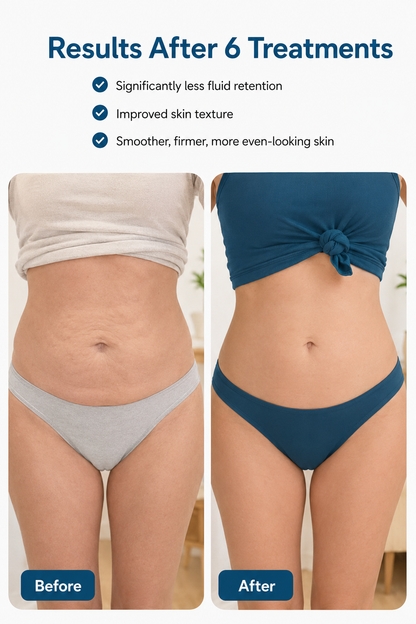 VITANEX Sculpt™ - Smart Body Shaping Massage